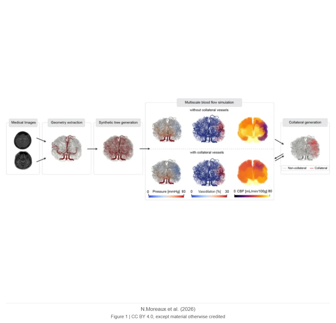 Computational modeling of collateral circulation and arteriolar vasodilation in ischemic tissue perfusion