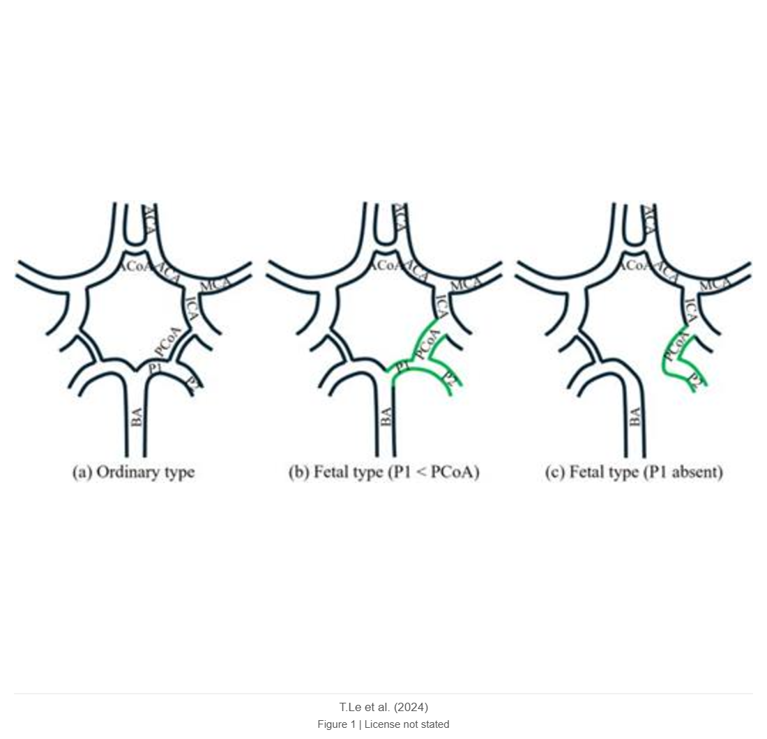 Assessing the Impact of Fetal-type Posterior Cerebral Artery Variations on Cerebral Hemodynamics