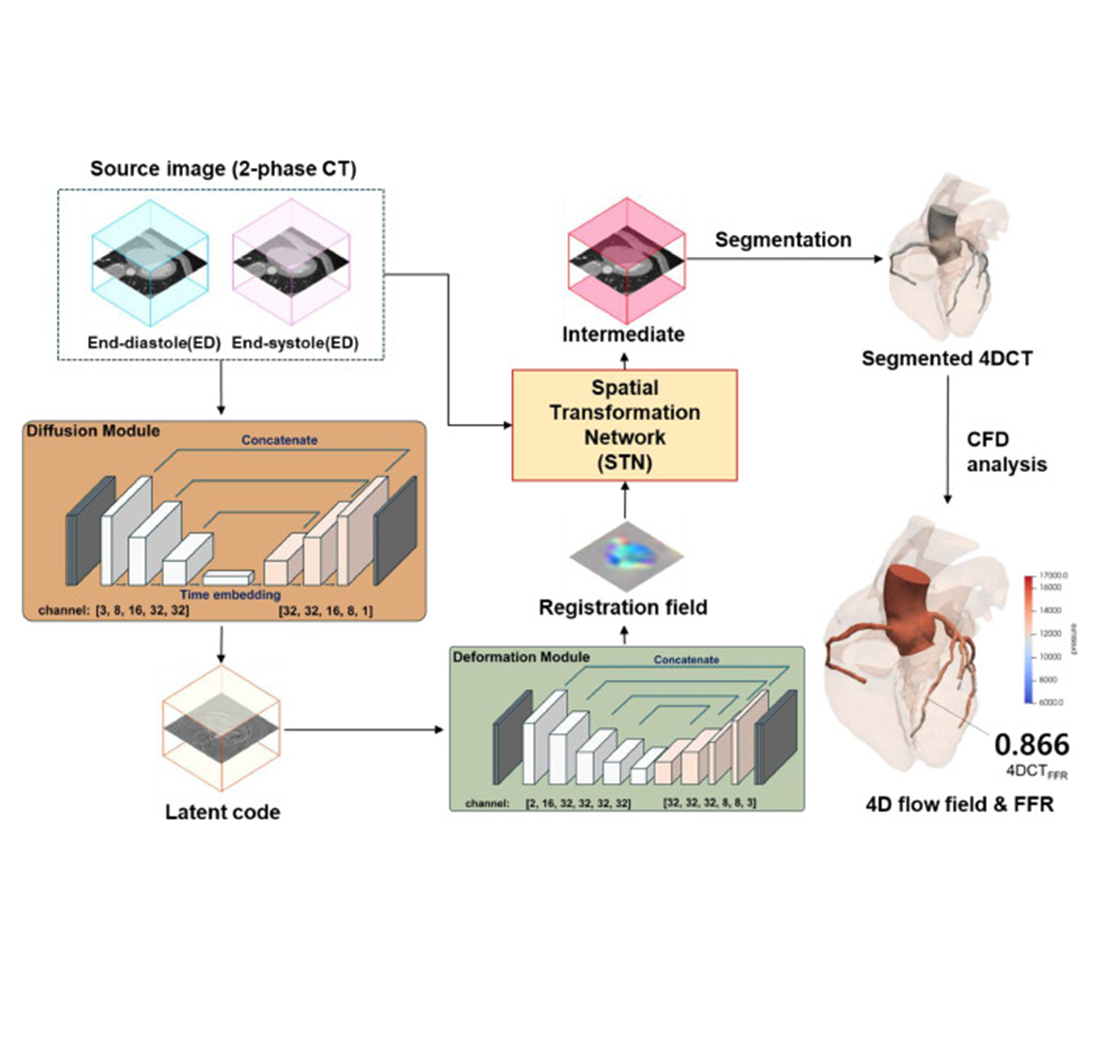 Synthesis of coronary 4D CT Image by denoising diffusion probabilistic model