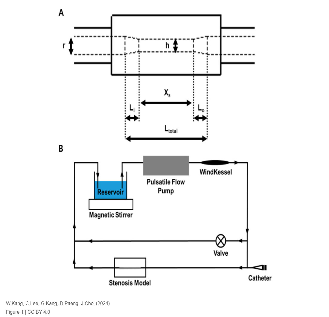 A Novel Method for Angiographic Contrast-Based Diagnosis of Stenosis in Coronary Artery Disease: In Vivo and In Vitro Analyses