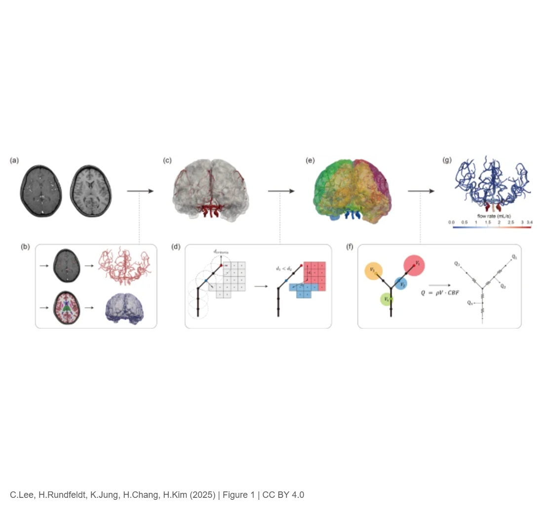 Physiologic model of the cerebrovascular system using supply and demand between arteries and tissues