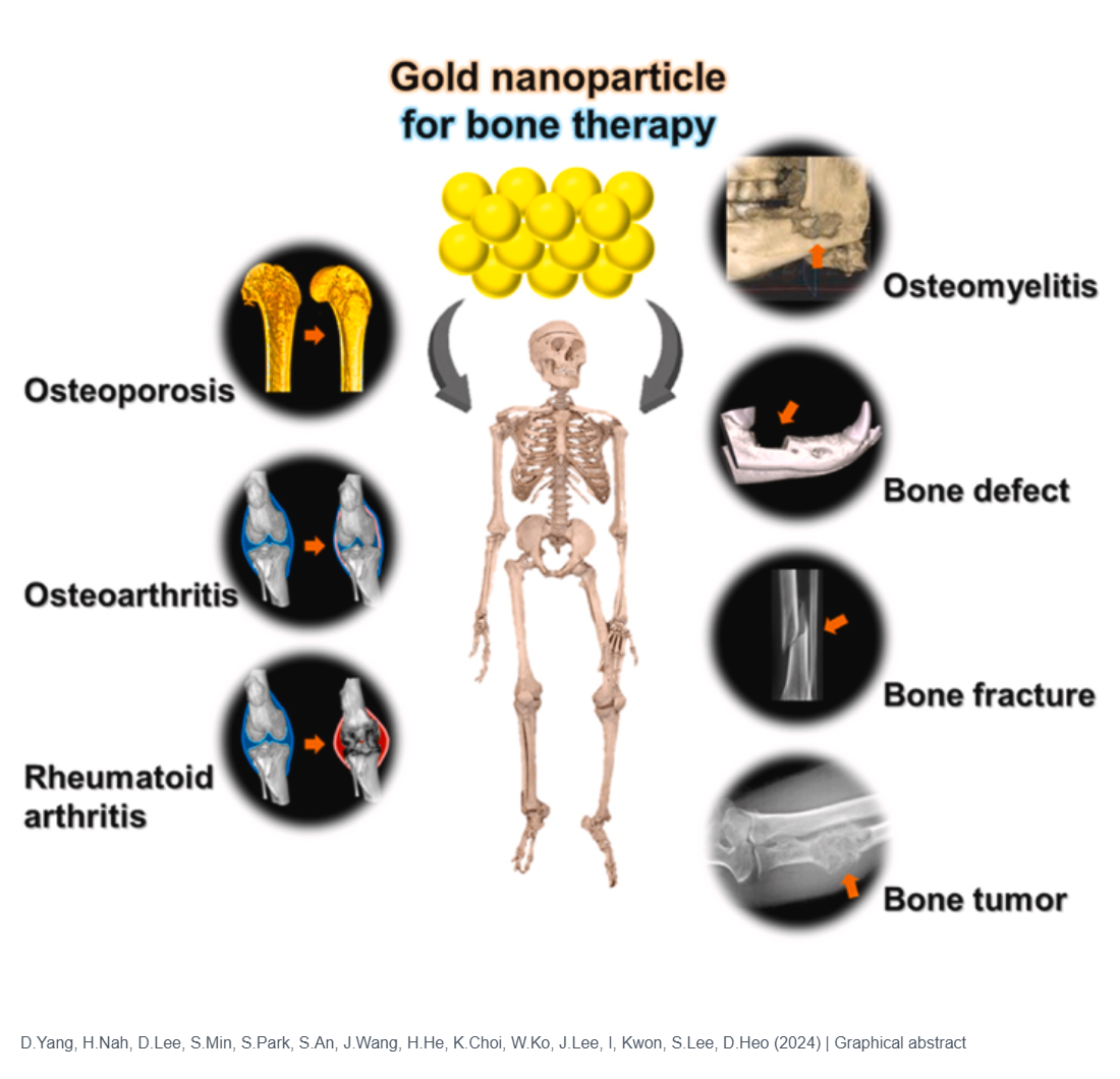 A review on gold nanoparticles as an innovative therapeutic cue in bone tissue engineering: Prospects and future clinical applications