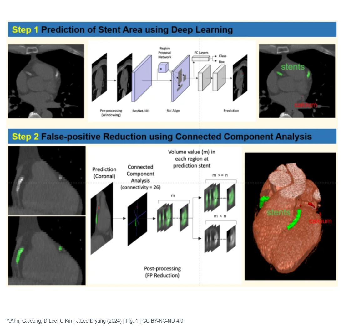 Automatic identification of coronary stent in coronary calcium scoring CT using deep learning