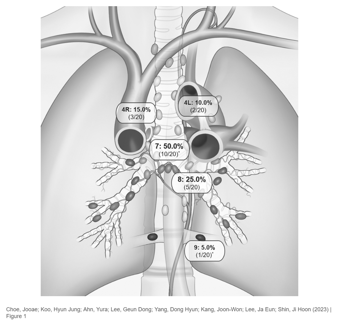 Evaluation of Chylothorax Using Dynamic Contrast-Enhanced Magnetic Resonance Lymphangiography After Lung Cancer Surgery