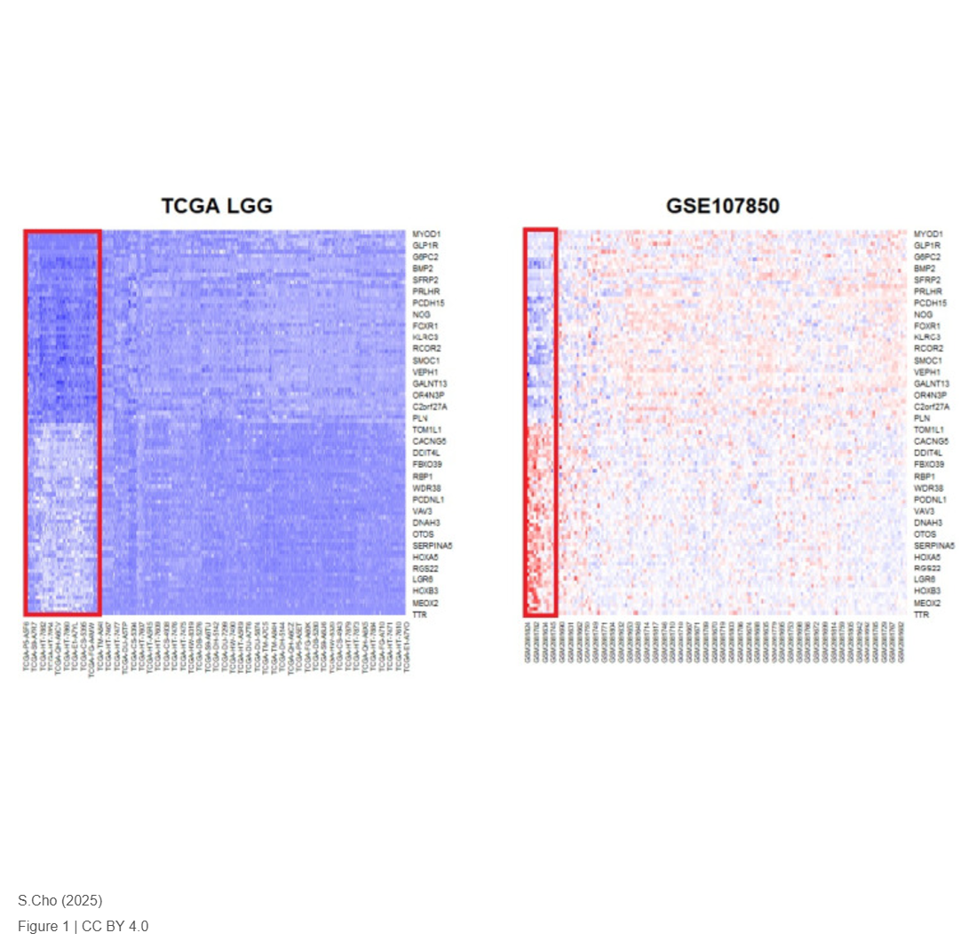 Transcriptomic Profile of Isocitrate Dehydrogenase Mutant Type of Lower-Grade Glioma Reveals Molecular Changes for Prognosis