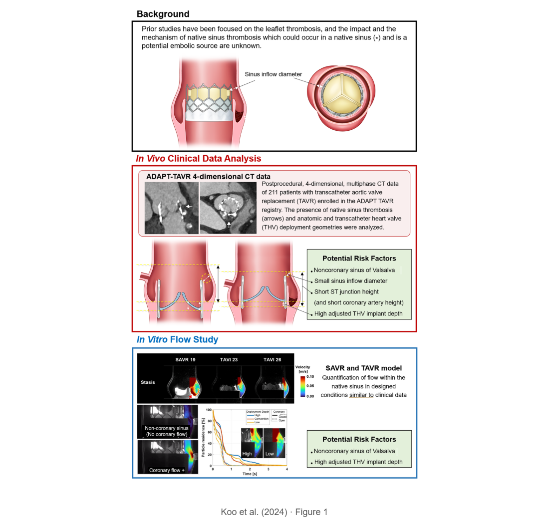 Native Sinus Hemodynamics and Thrombosis in Transcatheter Heart Valve: Effect of Implant Depth and Coronary Flow