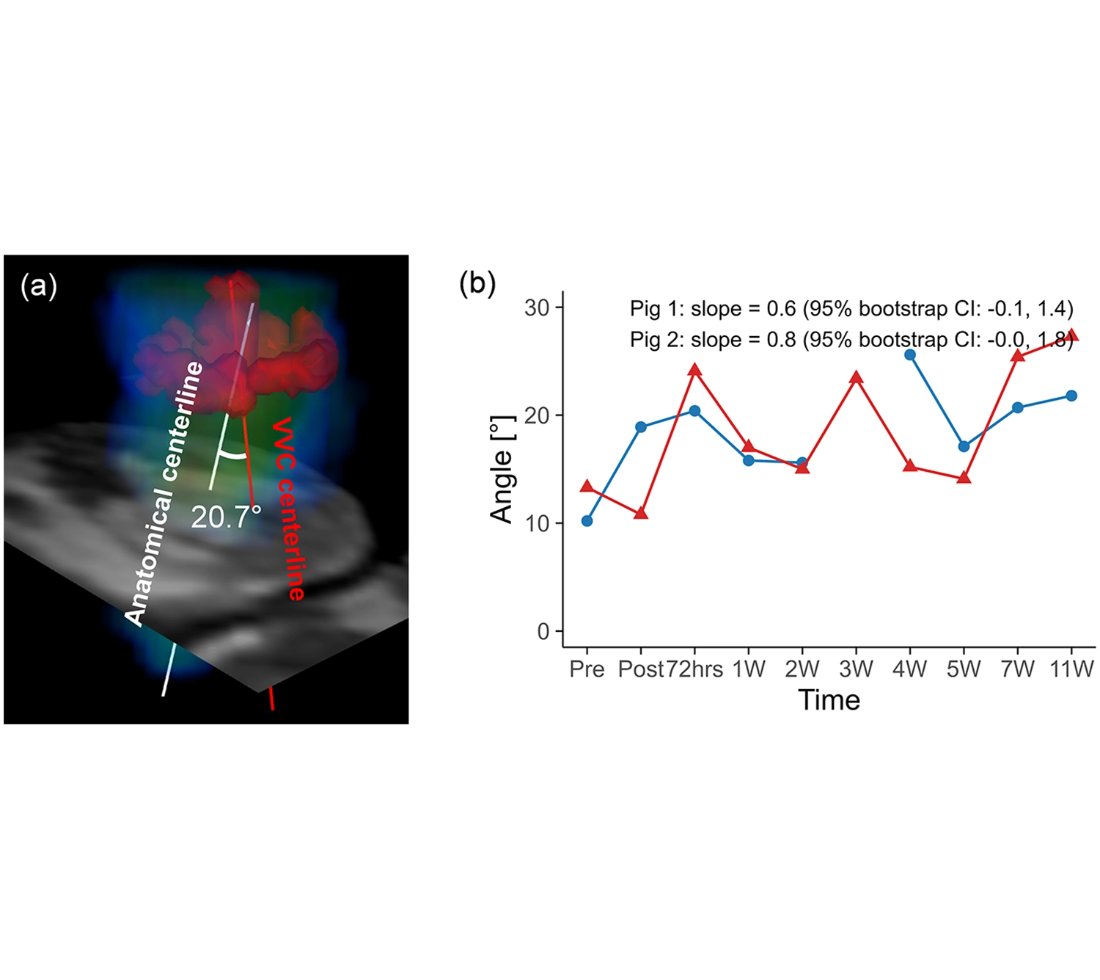 Longitudinal observation of left ventricular inflow reorientation with preserved vorticity after myocardial infarction in a porcine model