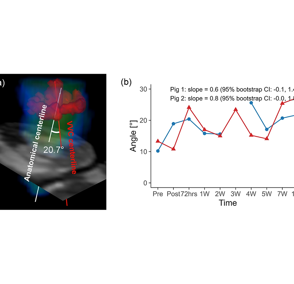 Longitudinal observation of left ventricular inflow reorientation with preserved vorticity after myocardial infarction in a porcine model — 논문 대표 이미지