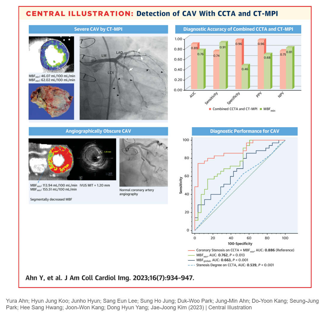 CT Coronary Angiography and Dynamic CT Myocardial Perfusion for Detection of Cardiac Allograft Vasculopathy.