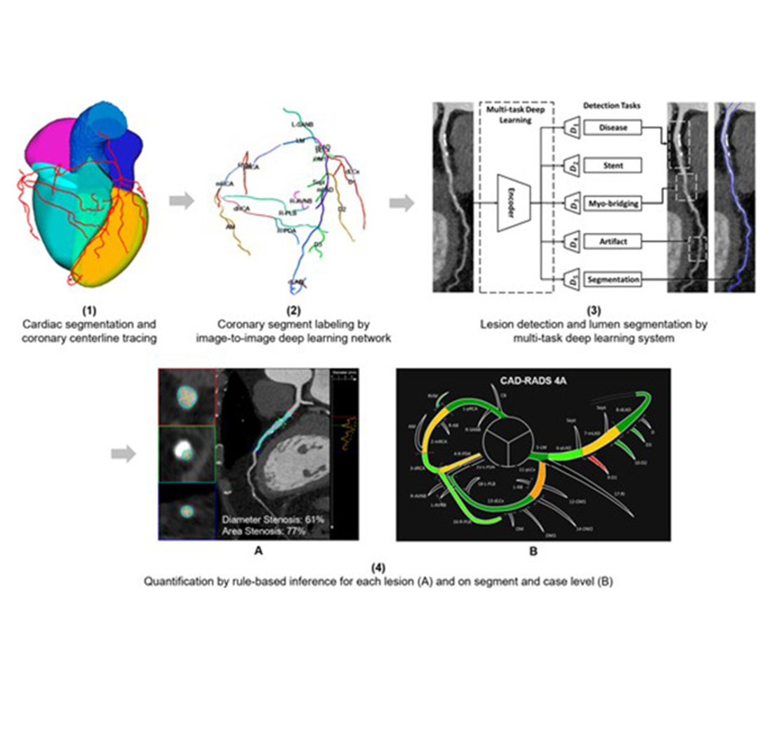 Artificial Intelligence-Driven Assessment of Coronary Computed Tomography Angiography for Intermediate Stenosis: Comparison With Quantitative Coronary Angiography and Fractional Flow Reserve
