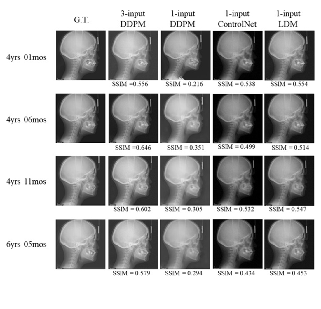 Time-series X-ray image prediction of dental skeleton treatment progress via neural networks