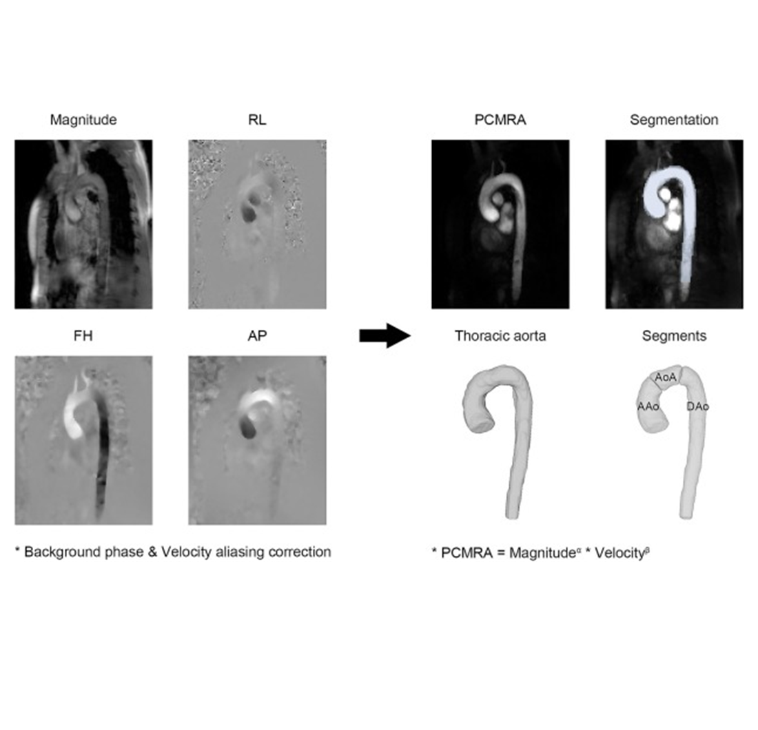 4D flow MRI of aortic blood flow parameters in healthy volunteers: Sex- and age-specific analysis