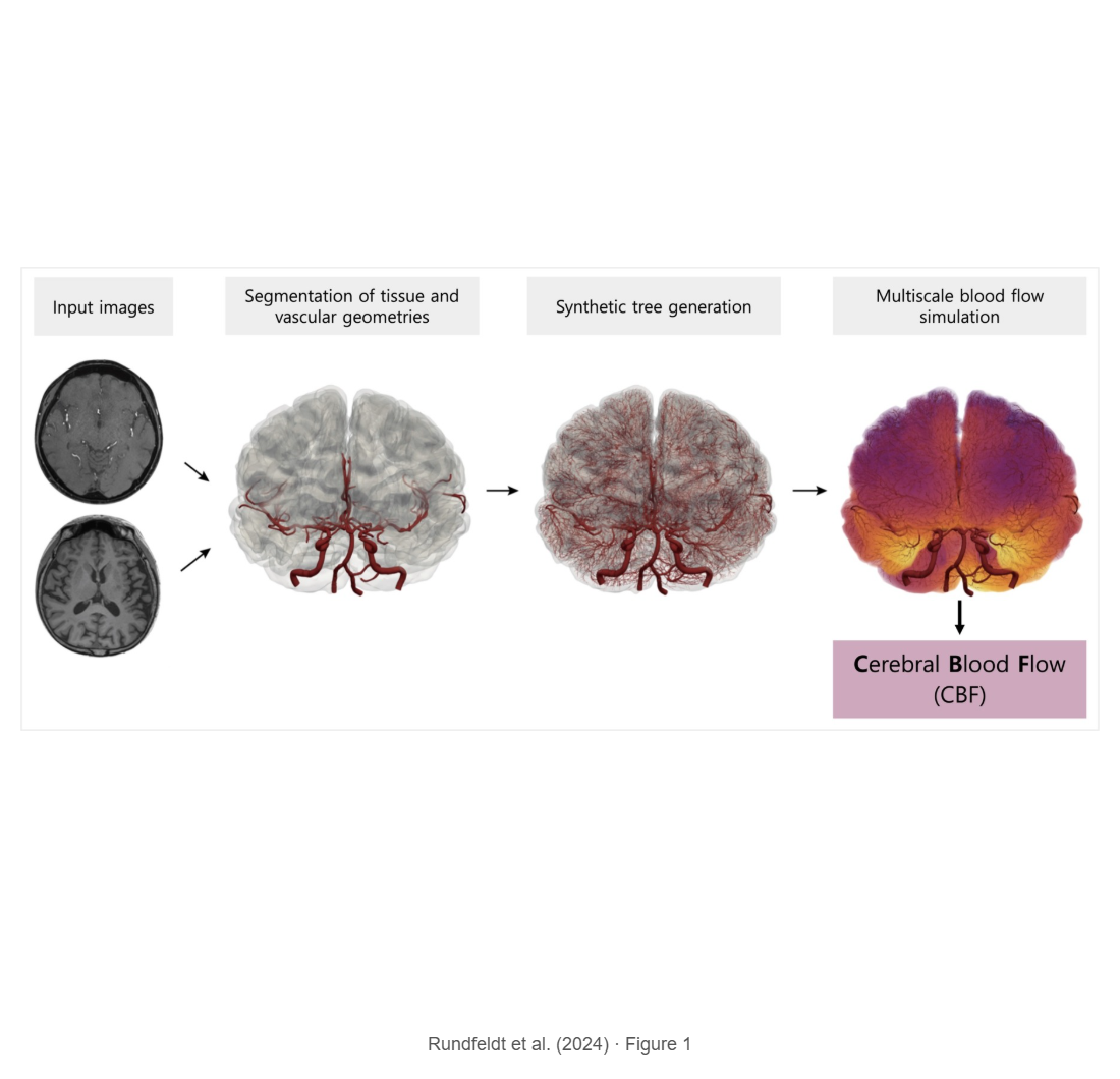 Cerebral perfusion simulation using realistically generated synthetic trees for healthy and stroke patients
