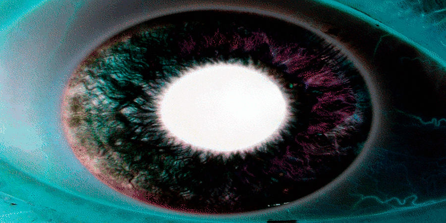 Eye-gif_2a.jpg