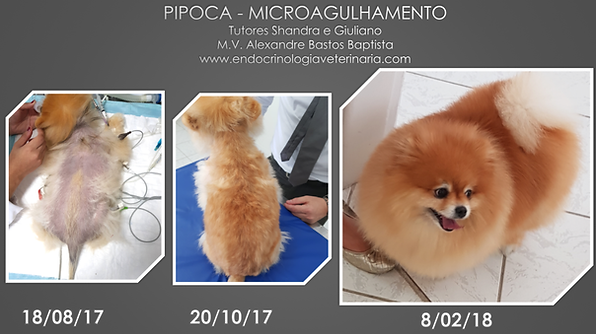 Microagulhamento Alopecia X