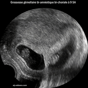 29.gif