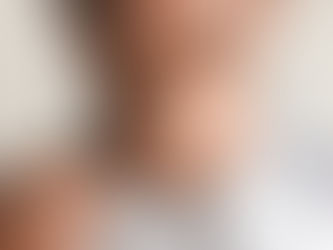 Could Hormone Imbalance Be Causing Your Dry Eye?