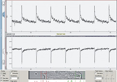 IonOptix_RealTime-Acquisition-Cell-Lengt