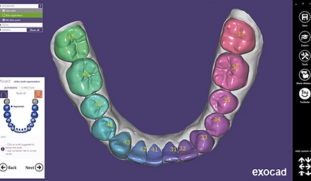 One-click tooth segmentation