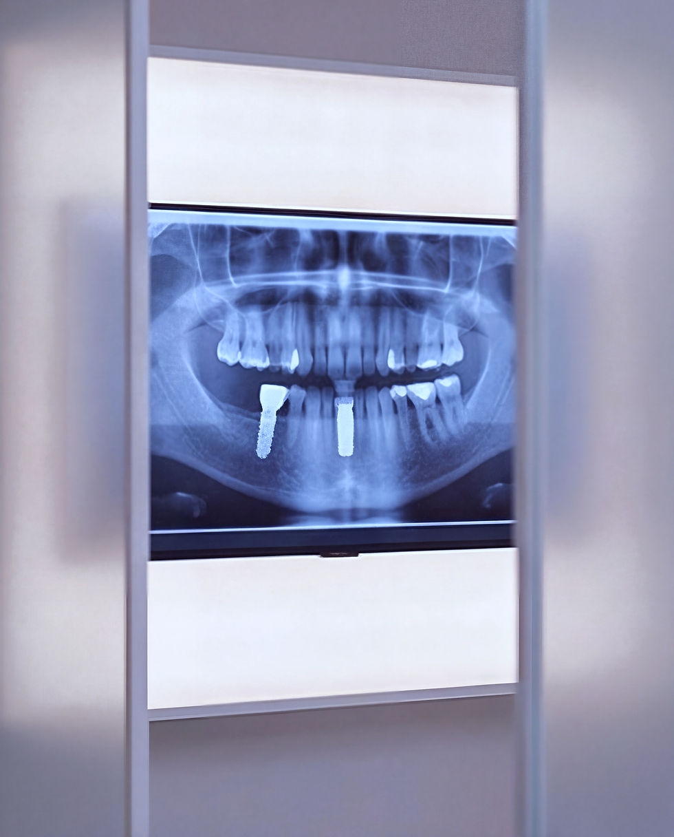 Radiografía para Implante dental en Clinica dental Gamero en Independencia