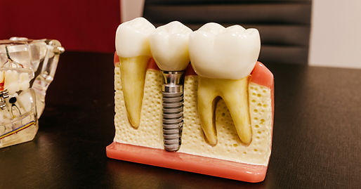 teeth-cleaning-process-1920w.webp