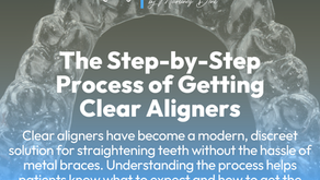 The Step-by-Step Process of Getting Clear Aligners