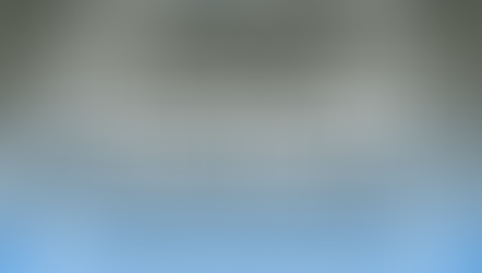 The Step-by-Step Process of Getting Clear Aligners