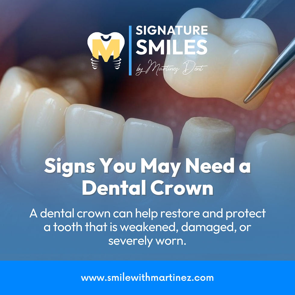 Signs You May Need a Dental Crown
