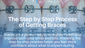 The Step by Step Process of Getting Braces