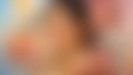 Beyond the Sun: Surprising Hyperpigmentation Causes You Didn't Know