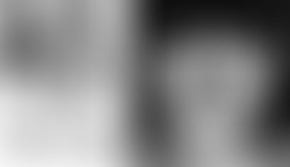 Effect of Prone Blocking on Step Length, Foot Splay