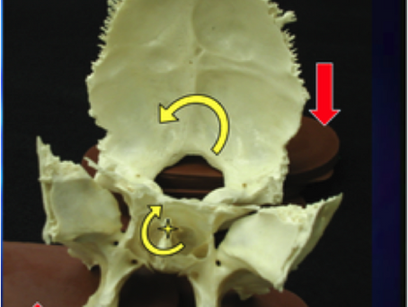 Exploring the Connection Between Sacro-Occipital Technique and Sphenobasilar Balance in Chiropractic Care