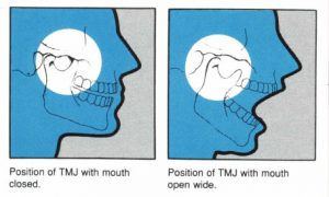 Integrating Dental and Chiropractic Care for Effective Treatment of Jaw Disorders