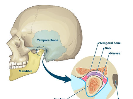 Evaluating the Necessity of Dental and Chiropractic Collaboration for TMJ Management