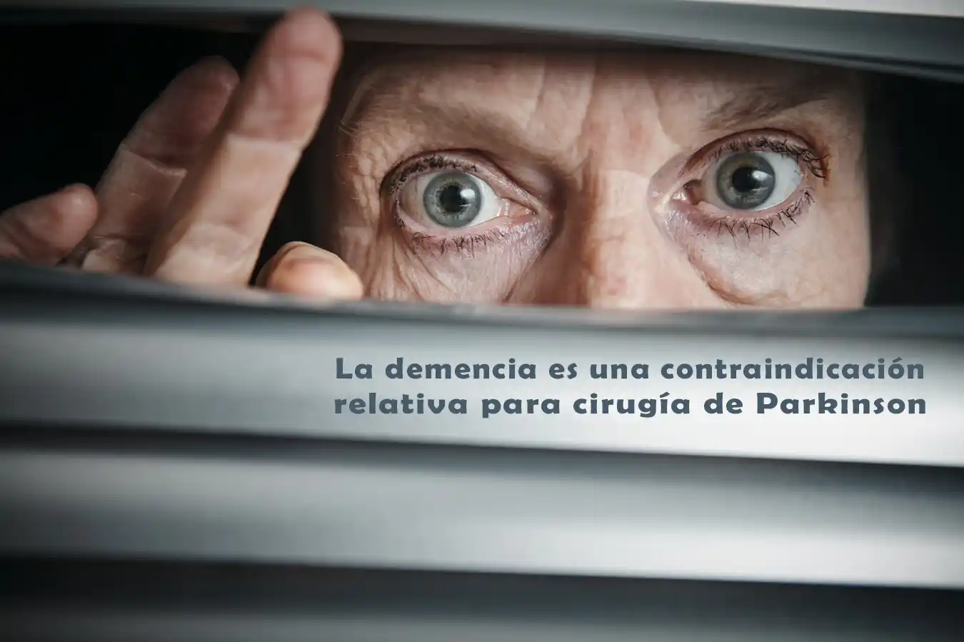 Señora con demencia que mira por la ventana.