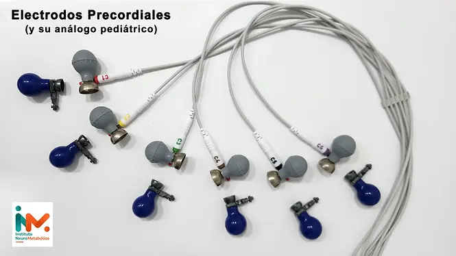 Electrodos precordiales WP.webp