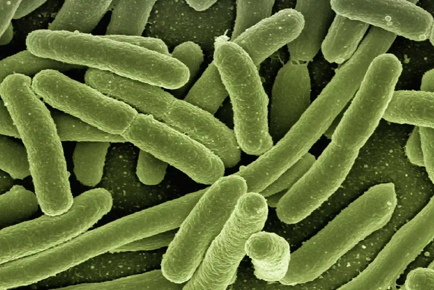 Bacterias en el sistema nervioso.