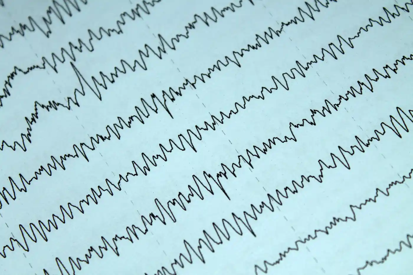 Trazado de electroencefalograma.