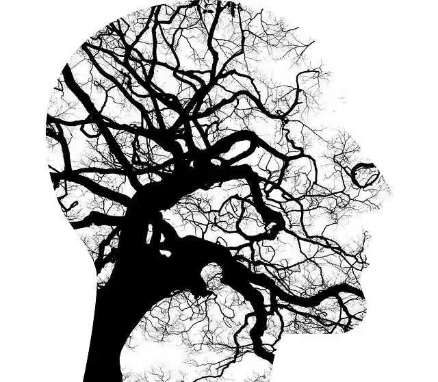 Dibujo de la circulación arterial cerebral.