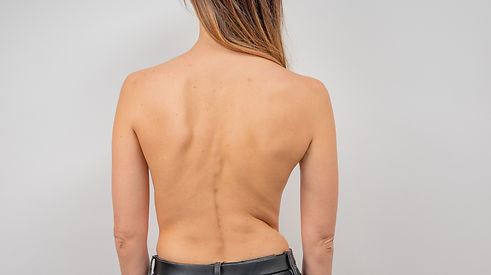 Back pain (4)_edited.jpg