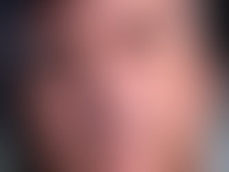 PF reconhece risco grave à saúde de Bolsonaro, mas rejeita mudança para prisão domiciliar