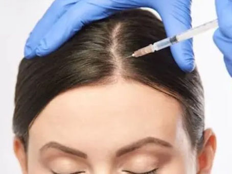 Best Hair Loss Treatments in Kochi and Angamaly: Everything You Need to Know