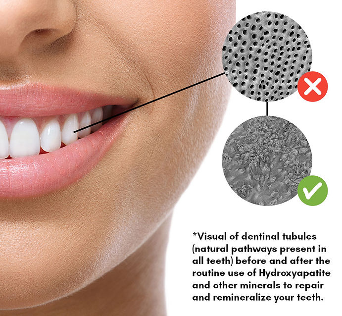 underbrush-graphic-for-teeth.jpg