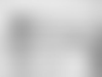 Justiça obriga Estado do Paraná a fornecer Ocrelizumabe para adolescente com Esclerose Múltipla