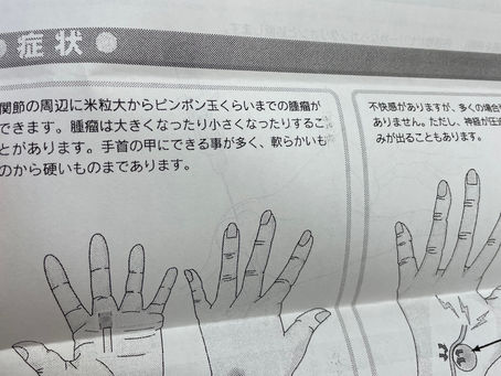 足首に異変が！その真相とは？