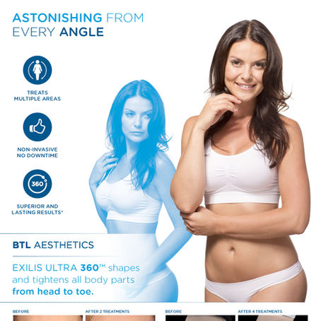 Exilis Elite Lexington Kentucky