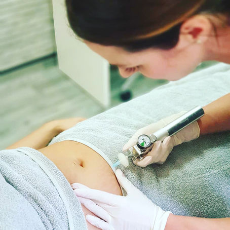 Carboxytherapy