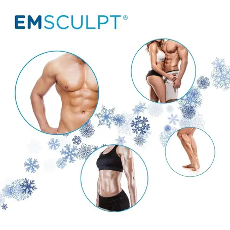 EMSculpt in Lexington KY to burn fat and build muscles