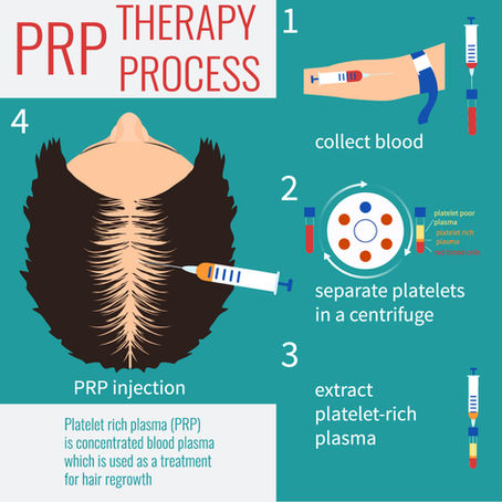 Hair Restoration with Platelet Rich Plasma