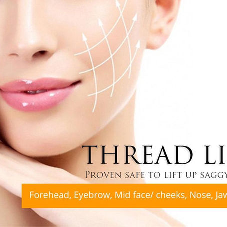 Thread lift